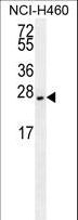 EIF4E2 / IF4e Antibody - EIF4E2/MB10227 antibody western blot of NCI-H460 cell line lysates (35 ug/lane). The EIF4E2/MB10227 antibody detected the EIF4E2/MB10227 protein (arrow).