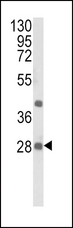 EIF4E2 / IF4e Antibody - Western blot of EIF4E2 Antibody in NCI-H460 cell line lysates (35 ug/lane). EIF4E2 (arrow) was detected using the purified antibody.