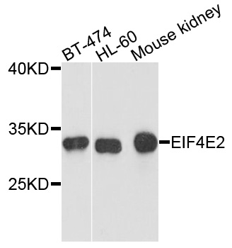 EIF4E2 / IF4e Antibody - Western blot analysis of extracts of various cells.