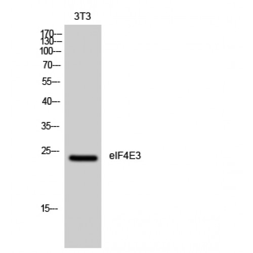 EIF4E3 Antibody - Western blot of eIF4E3 antibody