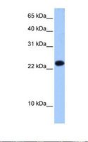 EIF4E3 Antibody - Fetal liver cell lysate. Antibody concentration: 0.5 ug/ml. Gel concentration: 15%.  This image was taken for the unconjugated form of this product. Other forms have not been tested.