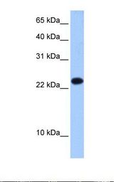 EIF4E3 Antibody - Fetal liver cell lysate. Antibody concentration: 0.5 ug/ml. Gel concentration: 15%.  This image was taken for the unconjugated form of this product. Other forms have not been tested.