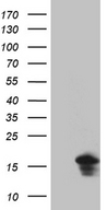 EIF4E3 Antibody - HEK293T cells were transfected with the pCMV6-ENTRY control. (Left lane) or pCMV6-ENTRY EIF4E3. (Right lane) cDNA for 48 hrs and lysed. Equivalent amounts of cell lysates. (5 ug per lane) were separated by SDS-PAGE and immunoblotted with anti-EIF4E3. (1:2000)