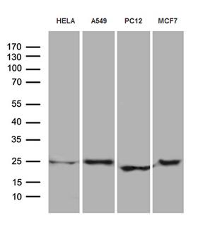 EIF4E3 Antibody - Western blot analysis of extracts. (35ug) from 4 different cell lines by using anti-EIF4E3 monoclonal antibody. (1:500)