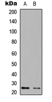 EIF4E3 Antibody - Western blot analysis of EIF4E3 expression in HEK293T (A); NIH3T3 (B) whole cell lysates.