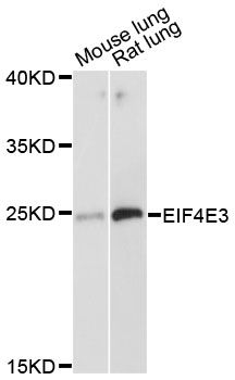 EIF4E3 Antibody - Western blot analysis of extracts of various cell lines, using EIF4E3 antibody at 1:3000 dilution. The secondary antibody used was an HRP Goat Anti-Rabbit IgG (H+L) at 1:10000 dilution. Lysates were loaded 25ug per lane and 3% nonfat dry milk in TBST was used for blocking. An ECL Kit was used for detection and the exposure time was 30s.