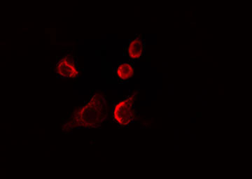 EIF4E3 Antibody - Staining LOVO cells by IF/ICC. The samples were fixed with PFA and permeabilized in 0.1% Triton X-100, then blocked in 10% serum for 45 min at 25°C. The primary antibody was diluted at 1:200 and incubated with the sample for 1 hour at 37°C. An Alexa Fluor 594 conjugated goat anti-rabbit IgG (H+L) antibody, diluted at 1/600, was used as secondary antibody.