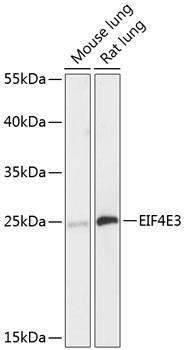 EIF4E3 Antibody - Western blot analysis of extracts of various cell lines using EIF4E3 Polyclonal Antibody at dilution of 1:3000.