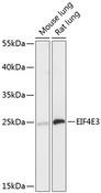 EIF4E3 Antibody - Western blot analysis of extracts of various cell lines using EIF4E3 Polyclonal Antibody at dilution of 1:3000.