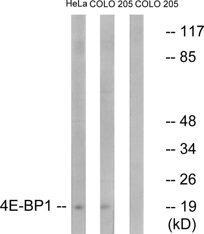 EIF4EBP1 / 4EBP1 Antibody - Western blot analysis of lysates from HeLa and COLO205 cells, treated with EGF 200ng/ml 5', using 4E-BP1 Antibody. The lane on the right is blocked with the synthesized peptide.
