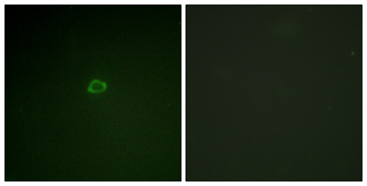 EIF4EBP1 / 4EBP1 Antibody - Immunofluorescence analysis of A549 cells, using 4E-BP1 Antibody. The picture on the right is blocked with the synthesized peptide.