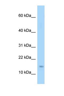 EIF4EBP1 / 4EBP1 Antibody - EIF4EBP1 / 4EBP1 antibody Western blot of Mouse Heart lysate. Antibody concentration 1 ug/ml.  This image was taken for the unconjugated form of this product. Other forms have not been tested.