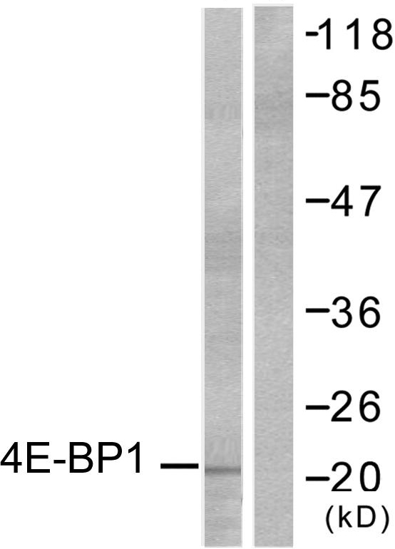 EIF4EBP1 / 4EBP1 Antibody - Western blot analysis of lysates from MDA-MB-435 cells, treated with EGF 200ng/ml 30', using 4E-BP1 Antibody. The lane on the right is blocked with the synthesized peptide.