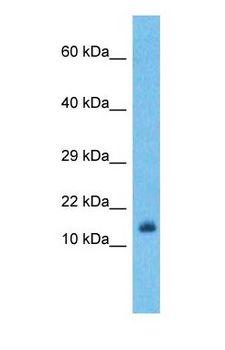 EIF4EBP1 / 4EBP1 Antibody - Western blot of 4EBP1 Antibody with human MDA-MB-435s Whole Cell lysate.  This image was taken for the unconjugated form of this product. Other forms have not been tested.
