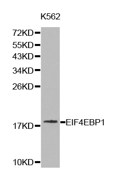 EIF4EBP1 / 4EBP1 Antibody - Western blot analysis of K562 cell lysate.