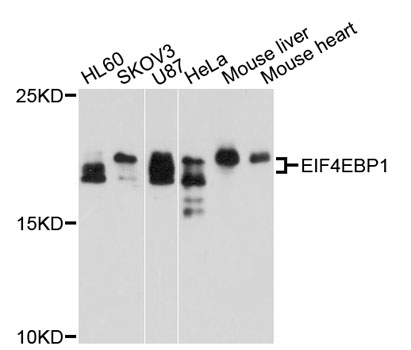 EIF4EBP1 / 4EBP1 Antibody - Western blot analysis of extracts of various cell lines, using EIF4EBP1 antibody at 1:1000 dilution. The secondary antibody used was an HRP Goat Anti-Rabbit IgG (H+L) at 1:10000 dilution. Lysates were loaded 25ug per lane and 3% nonfat dry milk in TBST was used for blocking. An ECL Kit was used for detection and the exposure time was 90s.