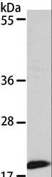 EIF4EBP1 / 4EBP1 Antibody - Western blot analysis of 293T cell, using EIF4EBP1 Polyclonal Antibody at dilution of 1:320.