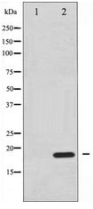 EIF4EBP1 / 4EBP1 Antibody - Western blot of 4E-BP1 expression in EGF treated MDA-MB-435 whole cell lysates,The lane on the left is treated with the antigen-specific peptide.