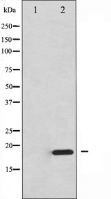 EIF4EBP1 / 4EBP1 Antibody - Western blot analysis of 4E-BP1 expression in EGF treated MDA-MB-435 whole cells lysates. The lane on the left is treated with the antigen-specific peptide.