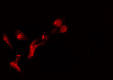 EIF4EBP1 / 4EBP1 Antibody - Staining HeLa cells by IF/ICC. The samples were fixed with PFA and permeabilized in 0.1% Triton X-100, then blocked in 10% serum for 45 min at 25°C. The primary antibody was diluted at 1:200 and incubated with the sample for 1 hour at 37°C. An Alexa Fluor 594 conjugated goat anti-rabbit IgG (H+L) antibody, diluted at 1/600, was used as secondary antibody.
