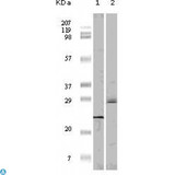 EIF4EBP1 / 4EBP1 Antibody - Immunohistochemistry (IHC) analysis of paraffin-embedded Human Pancreas carcinoma (A), esophagus carcinoma tissue (B) and ovary tumor tissue (C), showing cytoplasmic and membrane localization with DAB staining using 4E-BP1 Monoclonal Antibody.