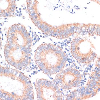 EIF4EBP1 / 4EBP1 Antibody - Immunohistochemistry of paraffin-embedded Human colon carcinoma using EIF4EBP1 Polyclonal Antibody at dilution of 1:100 (40x lens).