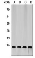 EIF4EBP1 / 4EBP1 Antibody - Western blot analysis of 4EBP1 expression in HEK293T (A); HepG2 (B); mouse brain (C); rat liver (D) whole cell lysates.