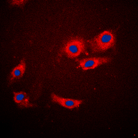 EIF4EBP1 / 4EBP1 Antibody - Immunofluorescent analysis of 4EBP1 staining in MCF7 cells. Formalin-fixed cells were permeabilized with 0.1% Triton X-100 in TBS for 5-10 minutes and blocked with 3% BSA-PBS for 30 minutes at room temperature. Cells were probed with the primary antibody in 3% BSA-PBS and incubated overnight at 4 deg C in a humidified chamber. Cells were washed with PBST and incubated with a DyLight 594-conjugated secondary antibody (red) in PBS at room temperature in the dark. DAPI was used to stain the cell nuclei (blue).