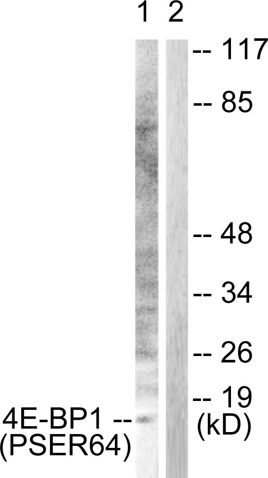 EIF4EBP1 / 4EBP1 Antibody - Western blot analysis of lysates from Jurkat cells treated with Insulin 0.01U/ml 15', using 4E-BP1 (Phospho-Ser64) Antibody. The lane on the right is blocked with the phospho peptide.