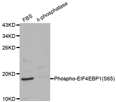 EIF4EBP1 / 4EBP1 Antibody - Western blot analysis on 293 cell lysates.