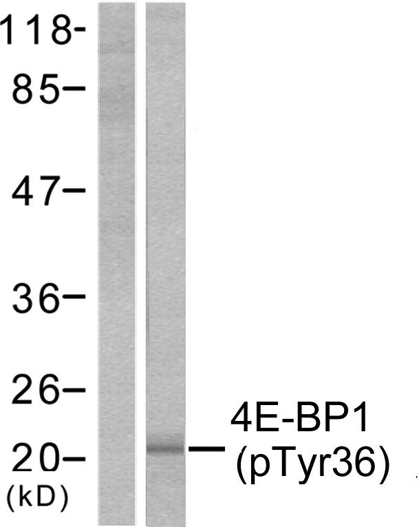 EIF4EBP1 / 4EBP1 Antibody - Western blot analysis of lysates from MDA-MB-435 cells treated with EGF 200ng/ml 30', using 4E-BP1 (Phospho-Thr36) Antibody. The lane on the left is blocked with the phospho peptide.