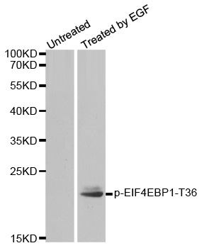EIF4EBP1 / 4EBP1 Antibody - Western blot analysis of extracts from MDA-MB-435 cells.