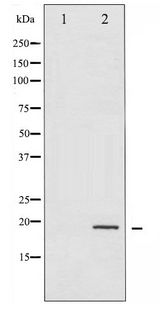EIF4EBP1 / 4EBP1 Antibody - Western blot of 4E-BP1 phosphorylation expression in EGF treated MDA-MB-435 whole cell lysates,The lane on the left is treated with the antigen-specific peptide.