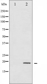 EIF4EBP1 / 4EBP1 Antibody - Western blot analysis of 4E-BP1 phosphorylation expression in EGF treated MDA-MB-435 whole cells lysates. The lane on the left is treated with the antigen-specific peptide.