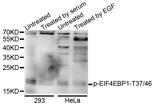 EIF4EBP1 / 4EBP1 Antibody - Western blot analysis of extracts of various cells.