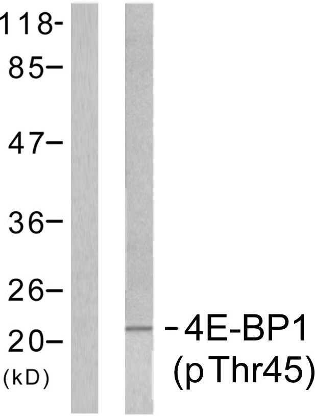 EIF4EBP1 / 4EBP1 Antibody - Western blot analysis of lysates from MDA-MB-435 cells treated with EGF 200ng/ml 5', using 4E-BP1 (Phospho-Thr45) Antibody. The lane on the right is blocked with the phospho peptide.