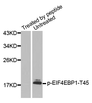 EIF4EBP1 / 4EBP1 Antibody - Western blot analysis of extracts from Hela cells.