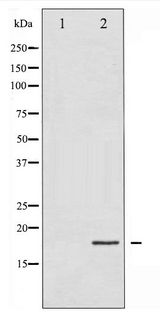 EIF4EBP1 / 4EBP1 Antibody - Western blot of 4E-BP1 phosphorylation expression in EGF treated MDA-MB-435 whole cell lysates,The lane on the left is treated with the antigen-specific peptide.