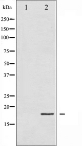 EIF4EBP1 / 4EBP1 Antibody - Western blot analysis of 4E-BP1 phosphorylation expression in EGF treated MDA-MB-435 whole cells lysates. The lane on the left is treated with the antigen-specific peptide.