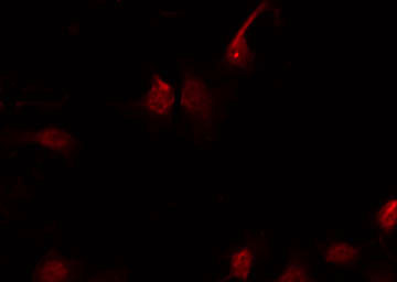EIF4EBP1 / 4EBP1 Antibody - Staining HeLa cells by IF/ICC. The samples were fixed with PFA and permeabilized in 0.1% Triton X-100, then blocked in 10% serum for 45 min at 25°C. The primary antibody was diluted at 1:200 and incubated with the sample for 1 hour at 37°C. An Alexa Fluor 594 conjugated goat anti-rabbit IgG (H+L) Ab, diluted at 1/600, was used as the secondary antibody.