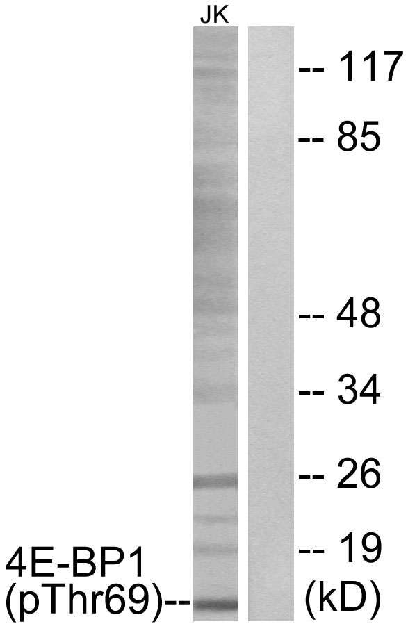 EIF4EBP1 / 4EBP1 Antibody - Western blot analysis of lysates from Jurkat cells treated with EGF 200ng/ml 30', using 4E-BP1 (Phospho-Thr69) Antibody. The lane on the right is blocked with the phospho peptide.