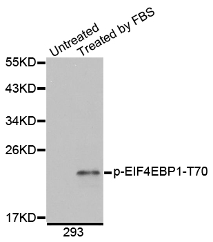 EIF4EBP1 / 4EBP1 Antibody - Western blot analysis of extracts of 293 cells.