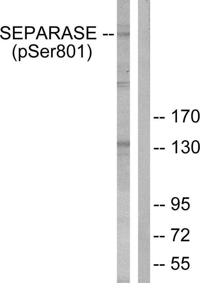 EIF4EBP1 / 4EBP1 Antibody - Western blot analysis of extracts from 293 cells, treated with EGF (200ng/ml, 30mins), using SEPARASE (Phospho-Ser801) antibody.