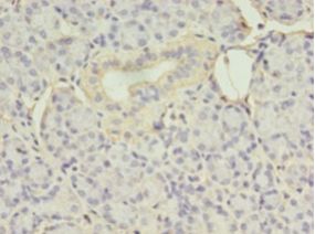 EIF4EBP3 Antibody - Immunohistochemistry of paraffin-embedded human pancreas tissue using antibody at 1:100 dilution.  This image was taken for the unconjugated form of this product. Other forms have not been tested.