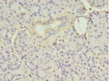 EIF4EBP3 Antibody - Immunohistochemistry of paraffin-embedded human pancreas tissue using antibody at 1:100 dilution.  This image was taken for the unconjugated form of this product. Other forms have not been tested.