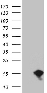 EIF4EBP3 Antibody - HEK293T cells were transfected with the pCMV6-ENTRY control. (Left lane) or pCMV6-ENTRY EIF4EBP3. (Right lane) cDNA for 48 hrs and lysed