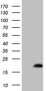 EIF4EBP3 Antibody - HEK293T cells were transfected with the pCMV6-ENTRY control. (Left lane) or pCMV6-ENTRY EIF4EBP3. (Right lane) cDNA for 48 hrs and lysed. Equivalent amounts of cell lysates. (5 ug per lane) were separated by SDS-PAGE and immunoblotted with anti-EIF4EBP3. (1:2000)