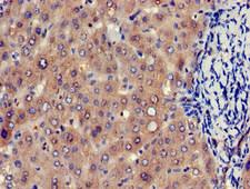 EIF4ENIF1 / 4E-T Antibody - Immunohistochemistry of paraffin-embedded human liver tissue at dilution of 1:100