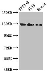 EIF4ENIF1 / 4E-T Antibody - Western Blot Positive WB detected in:HEK293 whole cell lysate,A549 whole cell lysate,Mouse brain tissue All Lanes:EIF4ENIF1 antibody at 2.7µg/ml Secondary Goat polyclonal to rabbit IgG at 1/50000 dilution Predicted band size: 109,89 KDa Observed band size: 130 KDa