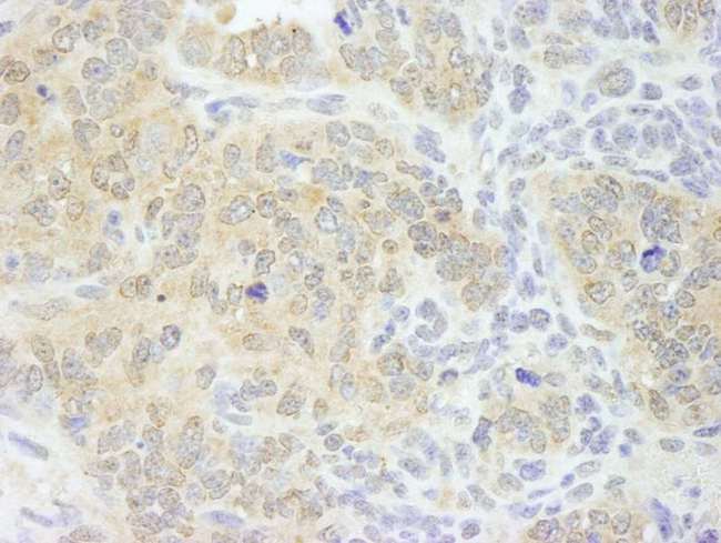 EIF4G1 / EIF4G Antibody - Detection of Mouse eIF4G1/eIF4GI by Immunohistochemistry. Sample: FFPE section of mouse teratoma. Antibody: Affinity purified rabbit anti-eIF4G1/eIF4GI used at a dilution of 1:500.